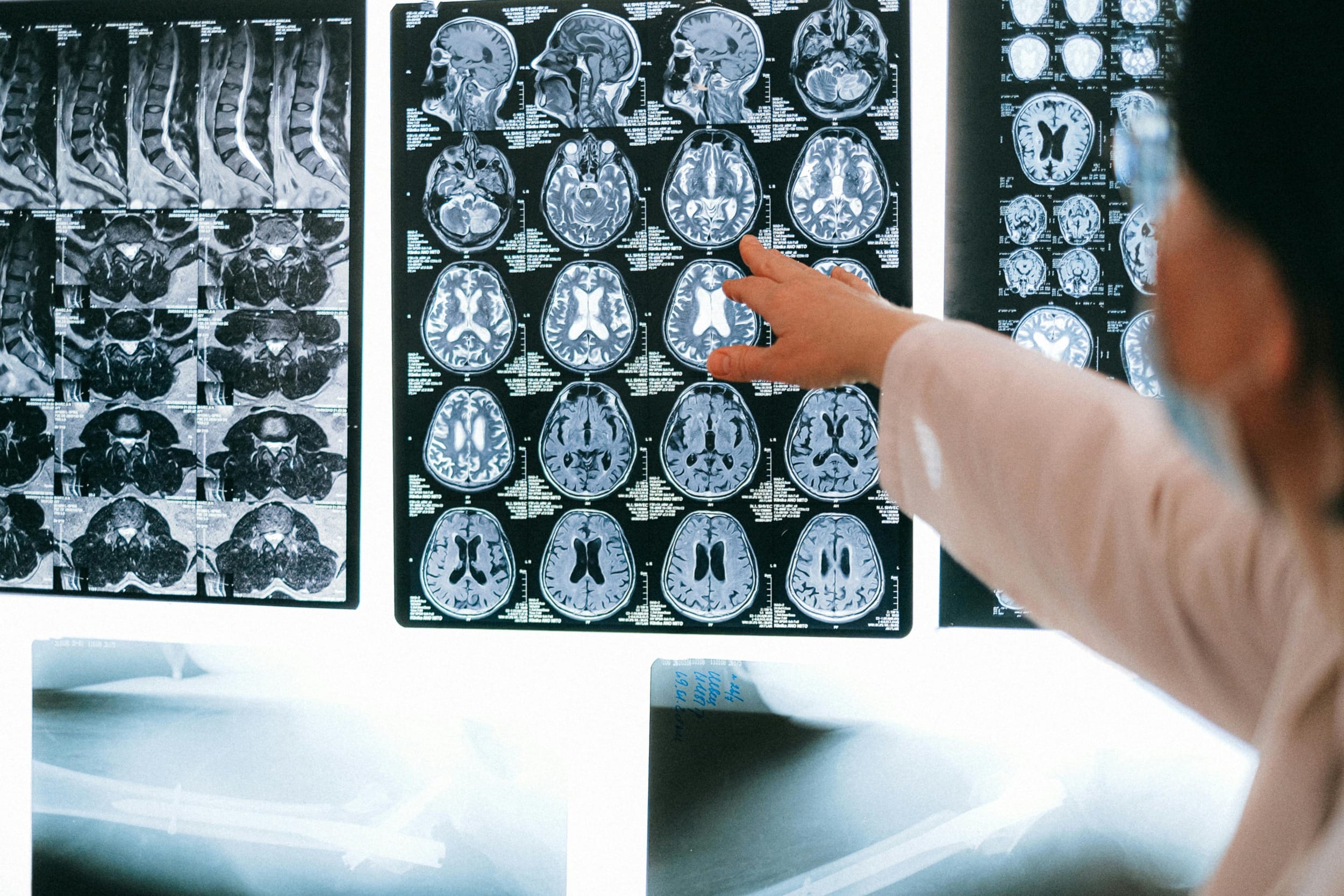 Ar teorinis neurovaizdavimas gali išspręsti probleminį interneto naudojimą?